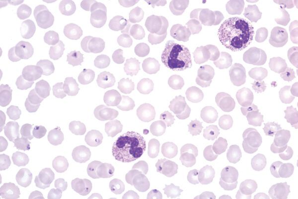 Field Stain B (For Microscopy)