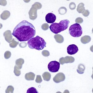 Giemsa’s Stain (For Microscopy)