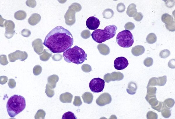 Giemsa's Stain (For Microscopy)